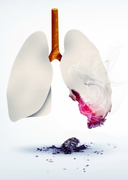 lung cancer screening in Brooklyn, ny lung cancer screening in Brooklyn, ny