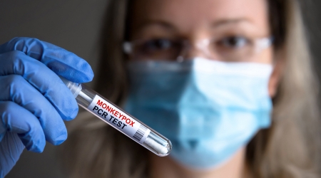 Monkeypox testing vial in Brooklyn Monkeypox testing vial in Brooklyn