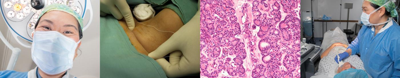 Endocrine Surgery